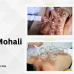 Best Cupping Therapist in Mohali