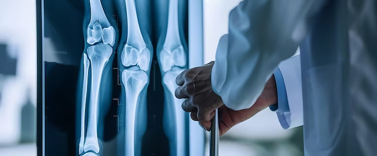 Best Orthopaedic Physiotherapists in Panchkula
